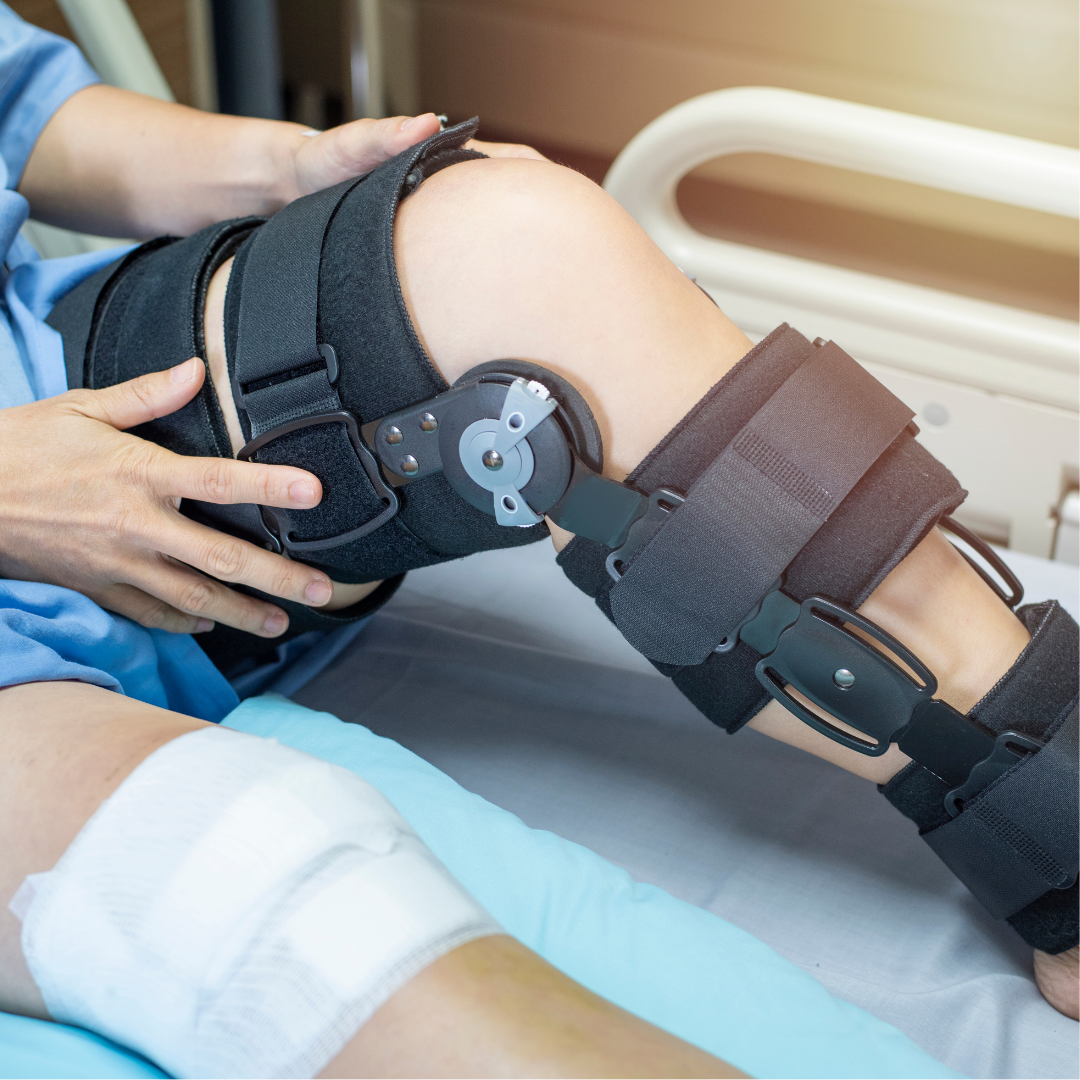 acl-surgery-recovery-timeline-sports-knee-therapy-acl-surgery